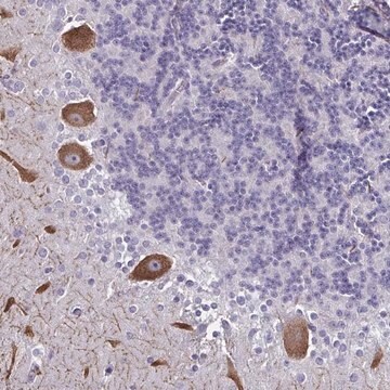 Anti-CHD5 antibody produced in rabbit Prestige Antibodies&#174; Powered by Atlas Antibodies, affinity isolated antibody, buffered aqueous glycerol solution