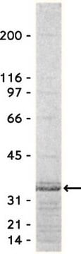 Rho-Assayreagenz (Rhotekin RBD, Agarose), 650&nbsp;&#181;g Specifically binds to &amp; precipitates GTP-Rho, but not GDP-Rho from cell lysates. For use in Affinity Binding Assays.