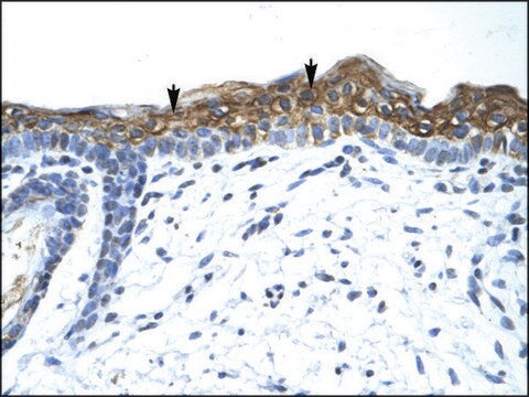 Anti-SUV420H1 antibody produced in rabbit affinity isolated antibody