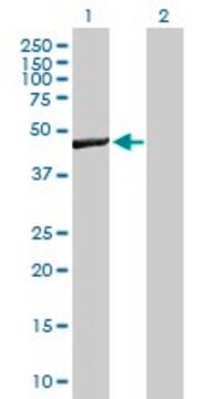 Anti-WBSCR16 antibody produced in mouse purified immunoglobulin, buffered aqueous solution