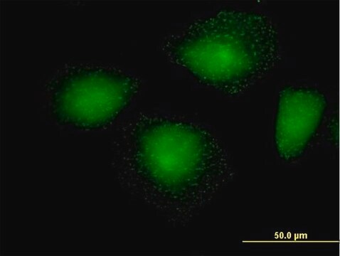 Anti-HIP1R antibody produced in mouse purified immunoglobulin, buffered aqueous solution