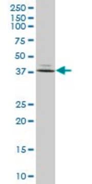 Anti-FBP1 antibody produced in mouse purified immunoglobulin, buffered aqueous solution