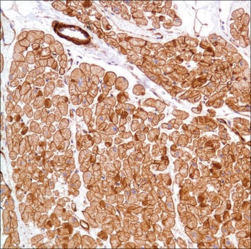 Anti-Vinculin antibody, Rabbit monoclonal clone SP117, recombinant, expressed in proprietary host, affinity isolated antibody