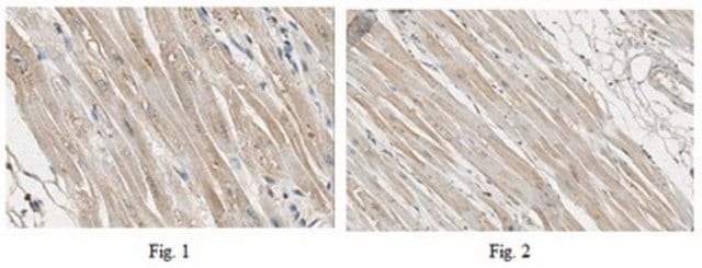 Anti-SYNPO2L Antibody from rabbit, purified by affinity chromatography