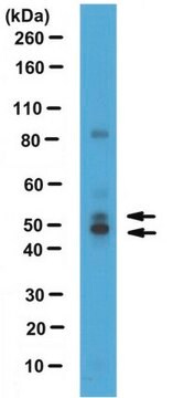 Anti-Nuclear factor 1/C Antibody serum, from rabbit