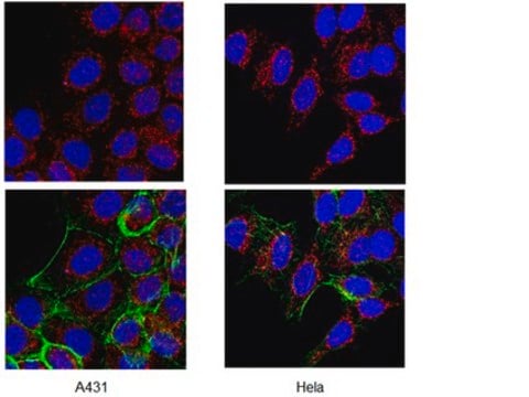 Anti-ADAM 17 Antibody Chemicon&#174;, from rabbit