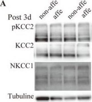 Anti-K+/Cl- Cotransporter (KCC2) Antibody Upstate&#174;, from rabbit