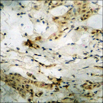 Anti-phospho-ATF2 (pThr73 or 55) antibody produced in rabbit affinity isolated antibody