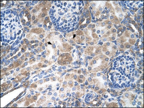 Anti-LAB antibody produced in rabbit affinity isolated antibody