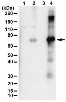 Anti-Phospho-METTL3 (Ser 43)