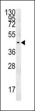 ANTI-PGAP2 (C-TERM) antibody produced in rabbit IgG fraction of antiserum, buffered aqueous solution