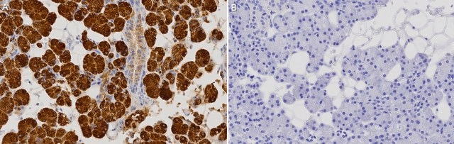 Anti-pan-Amylase Antibody, clone 3K13 ZooMAb&#174; Rabbit Monoclonal recombinant, expressed in HEK 293 cells