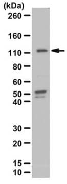 Anti-Phospho-STAT2(Tyr689)-Antikörper from rabbit, purified by affinity chromatography