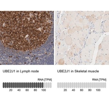 Anti-UBE2J1 antibody produced in rabbit Prestige Antibodies&#174; Powered by Atlas Antibodies, affinity isolated antibody, buffered aqueous glycerol solution