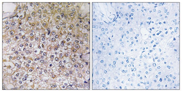 Anti-ATP6V1B1 antibody produced in rabbit affinity isolated antibody