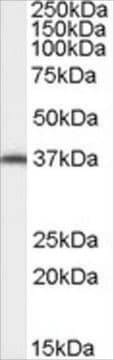 Anti-AIP/ARA9 antibody produced in goat affinity isolated antibody, buffered aqueous solution