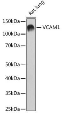 Anti-VCAM1 Antibody, clone 7I1J9, Rabbit Monoclonal