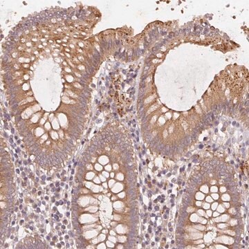 Anti-KLHL15 antibody produced in rabbit Prestige Antibodies&#174; Powered by Atlas Antibodies, affinity isolated antibody, buffered aqueous glycerol solution