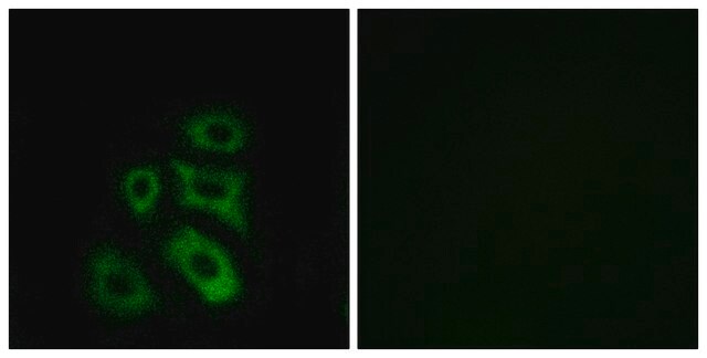 Anti-CLIP3 antibody produced in rabbit affinity isolated antibody