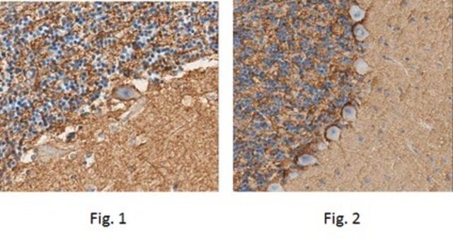 Anti-Sodium Pump Subunit alpha-2 Antibody from rabbit, purified by affinity chromatography