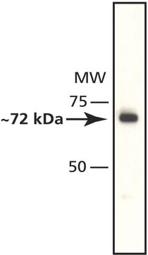 Anti-Histone Deacetylase 10 (HDAC10) antibody produced in rabbit affinity isolated antibody, buffered aqueous solution