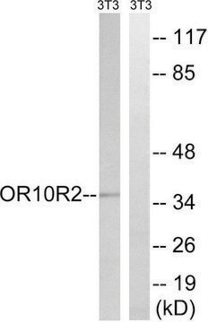 Anti-MAGEA5 antibody produced in rabbit affinity isolated antibody