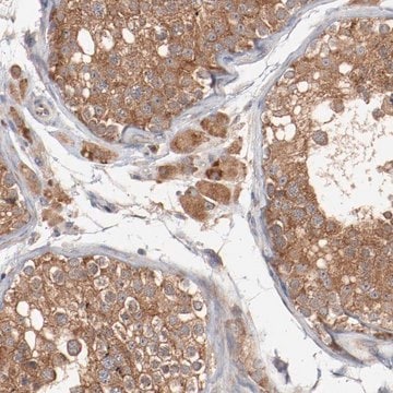 Anti-RNASE11 antibody produced in rabbit Prestige Antibodies&#174; Powered by Atlas Antibodies, affinity isolated antibody, buffered aqueous glycerol solution