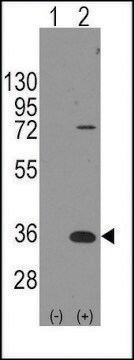 Anti-PARP16 (N-term) antibody produced in rabbit saturated ammonium sulfate (SAS) precipitated, buffered aqueous solution