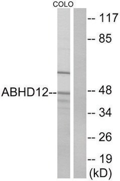 Anti-ABHD12 antibody produced in rabbit affinity isolated antibody