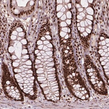 Anti-ANP32A antibody produced in rabbit Prestige Antibodies&#174; Powered by Atlas Antibodies, affinity isolated antibody, buffered aqueous glycerol solution