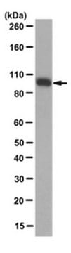 Anticuerpo anti-isocitrato deshidrogenasa 1 (IDH1)-R132H, clon HMab-1 clone HMab-1, from mouse