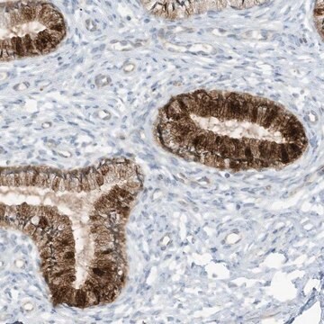 Anti-SCGB1D2 antibody produced in rabbit Prestige Antibodies&#174; Powered by Atlas Antibodies, affinity isolated antibody, buffered aqueous glycerol solution