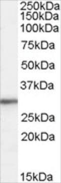 Anti-Ribosomal Protein L8 antibody produced in goat affinity isolated antibody, buffered aqueous solution