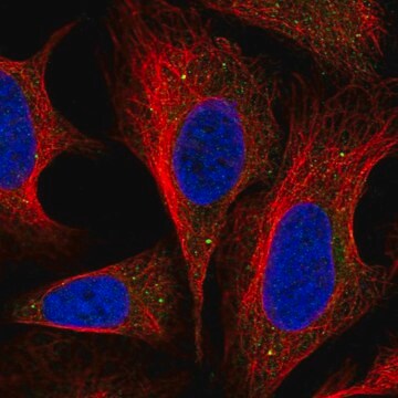 Anti-DNAJC22 antibody produced in rabbit Prestige Antibodies&#174; Powered by Atlas Antibodies, affinity isolated antibody