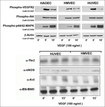 Human Aortic Endothelial Cells: HAOEC: Pre-Screened for Angiogenesis &amp; VEGF signaling, adult