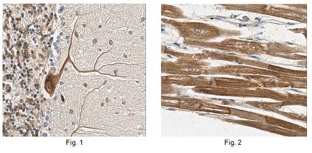 Anti-OCRL/INPP5b Antibody, clone N166A/26 clone N166A/26, from mouse