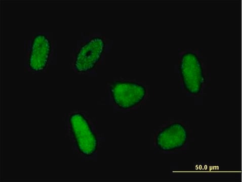 Anti-RNF168 antibody produced in mouse purified immunoglobulin, buffered aqueous solution