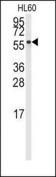 Anti-CYP4Z1 (N-term) antibody produced in rabbit saturated ammonium sulfate (SAS) precipitated, buffered aqueous solution