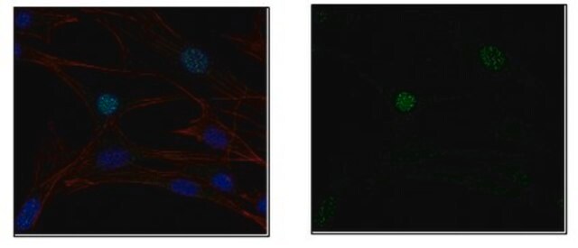 Anti-E3 ubiquitin-protein ligase UHRF1, clone BF18.11 Antibody clone BF18.11, from mouse