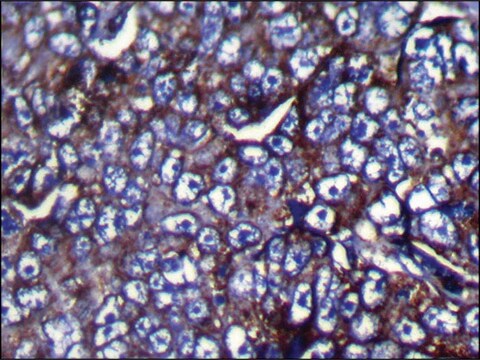 Anti-ZFP91 affinity isolated antibody