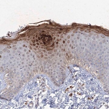 Anti-TANC1 antibody produced in rabbit Prestige Antibodies&#174; Powered by Atlas Antibodies, affinity isolated antibody, buffered aqueous glycerol solution