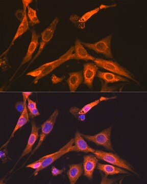 Anti-S100A6 Antibody, clone 0J1Q5, Rabbit Monoclonal