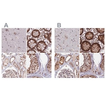 Anti-POLR2C antibody produced in rabbit Prestige Antibodies&#174; Powered by Atlas Antibodies, affinity isolated antibody, buffered aqueous glycerol solution