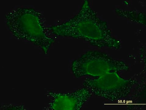 Monoclonal Anti-ALDH9A1 antibody produced in mouse clone 3C6, purified immunoglobulin, buffered aqueous solution