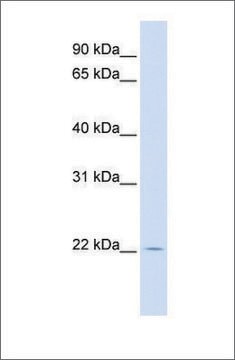 Anti-RHEBL1 antibody produced in rabbit affinity isolated antibody