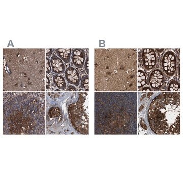 Anti-PEX5 antibody produced in rabbit Prestige Antibodies&#174; Powered by Atlas Antibodies, affinity isolated antibody, buffered aqueous glycerol solution