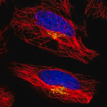 Anti-ATP7A antibody produced in rabbit Prestige Antibodies&#174; Powered by Atlas Antibodies, affinity isolated antibody