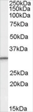 Anti-PSME1 (Isoform 1) antibody produced in goat affinity isolated antibody, buffered aqueous solution