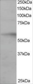 Anti-IRF6 antibody produced in goat affinity isolated antibody, buffered aqueous solution