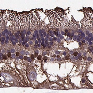 Anti-RLBP1 antibody produced in rabbit Prestige Antibodies&#174; Powered by Atlas Antibodies, affinity isolated antibody